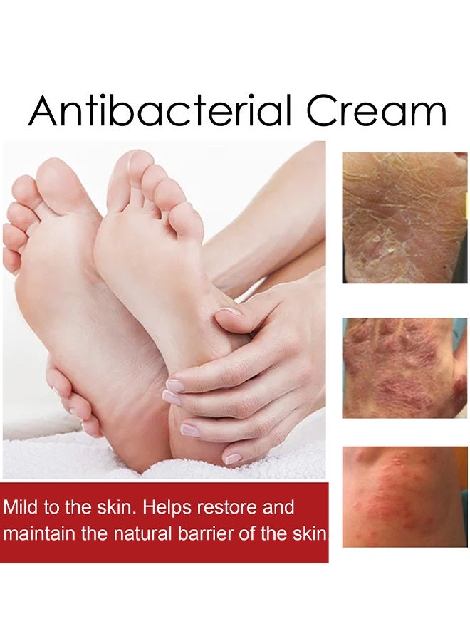 SOUTH MOON Antibacterial Cream, Psoriasis Cream, Natural Chinese Herbal Eczema Psoriasis Creams Dermatitis And Eczema Pruritus Psoriasis Ointment, Psoriasis Creams, Psoriasis Treatment, Antibacterial Cream, For Body Itching 30G - Image 3